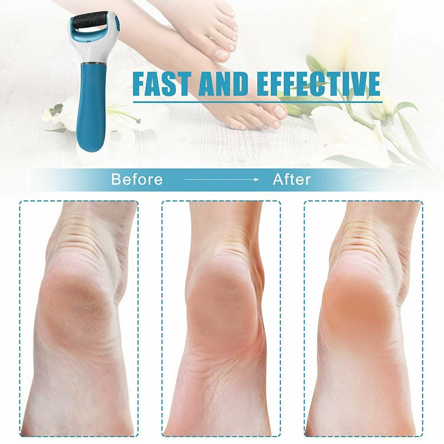 Electronic Dry Foot File Callous Remover For Feet Electric Foot With Roller Hard And Dead Skin